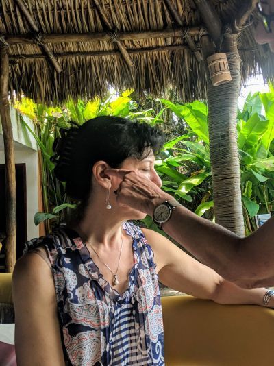 Auricular acupuncture in Yucatan Clinic